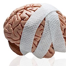 Traumatic brain injury hesi case study