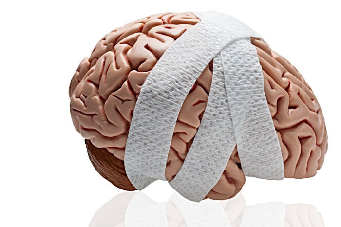 Traumatic brain injury hesi case study