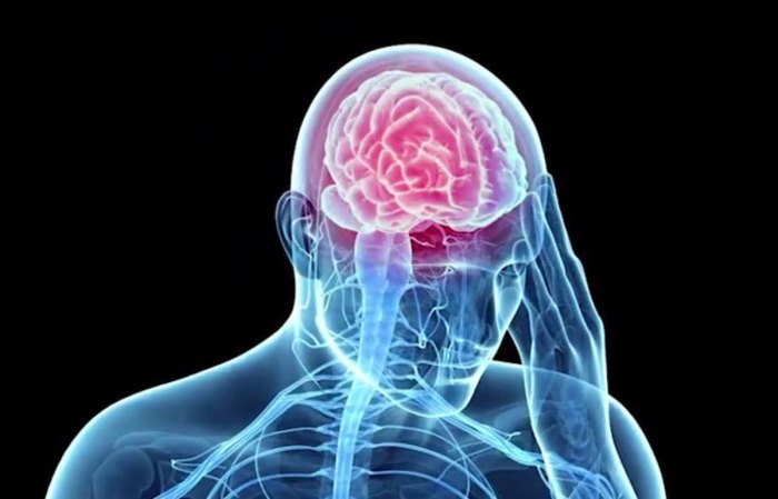 Traumatic brain injury hesi case study