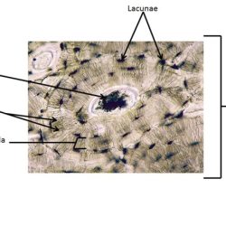 Label the photomicrograph of compact bone