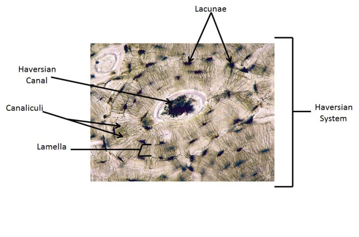 Label the photomicrograph of compact bone