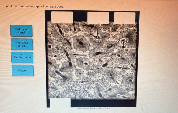 Label the photomicrograph of compact bone